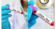 Xét nghiệm ADN năm 2024 cần chuẩn bị những gì?