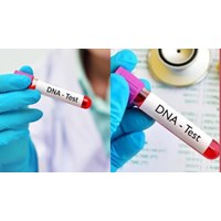 Xét nghiệm ADN năm 2024 cần chuẩn bị những gì?