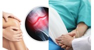 Phương pháp xác định tỷ lệ phần trăm tổn thương cơ thể hiện nay?