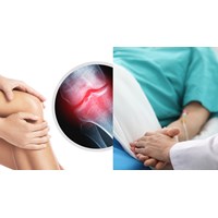 Phương pháp xác định tỷ lệ phần trăm tổn thương cơ thể hiện nay?