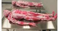 Quy định hiện hành về quyền được hiến xác sau khi chết?