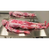 Quy định hiện hành về quyền được hiến xác sau khi chết?