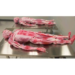 Quy định hiện hành về quyền được hiến xác sau khi chết?