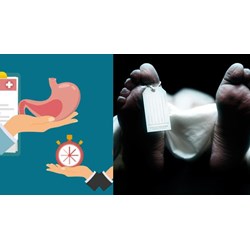 Quy định về nguyên tắc trong việc hiến xác sau khi chết thế nào?