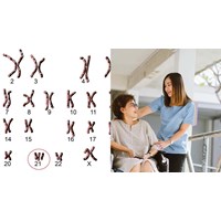 Một số chính sách pháp luật ưu đãi dành cho người Down mới nhất?