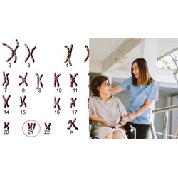 Một số chính sách pháp luật ưu đãi dành cho người Down mới nhất?