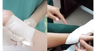 Có thể thực hiện thay băng vết thương ở trạm y tế hay không?