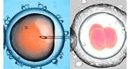 Chi phí thực hiện thụ tinh trong ống nghiệm khoảng bao nhiêu tiền?