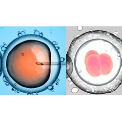 Chi phí thực hiện thụ tinh trong ống nghiệm khoảng bao nhiêu tiền?