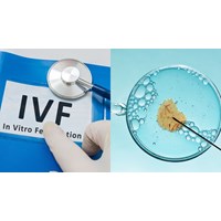 Thực hiện kỹ thuật thụ tinh trong ống nghiệm gồm mấy bước?
