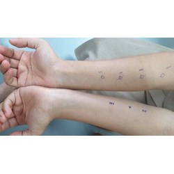 Có bắt buộc phải test da để thử phản ứng phản vệ khi đi tiêm thuốc?
