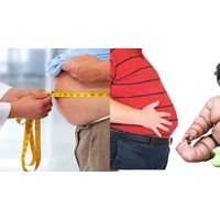 Bệnh béo phì là bệnh gì? Tìm hiểu ngày thế giới phòng chống béo phì