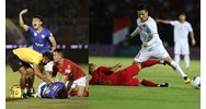 Cầu thủ có được nẹp sắt vào chân khi tham gia đá bóng không?