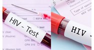 Quy định về kết quả xét nghiệm HIV không xác định thế nào?
