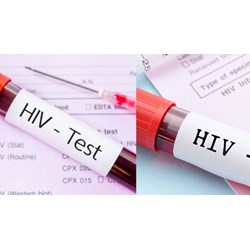 Quy định về kết quả xét nghiệm HIV không xác định thế nào?