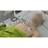 Nghi phạm đánh học sinh lớp 8 chết não có thể bị truy cứu hình sự?
