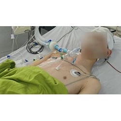 Nghi phạm đánh học sinh lớp 8 chết não có thể bị truy cứu hình sự?