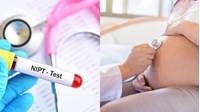 Xét nghiệm NIPT là gì? Tất tần tật thông tin mẹ bầu cần biết