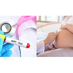 Xét nghiệm NIPT là gì? Tất tần tật thông tin mẹ bầu cần biết