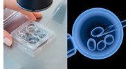 IVF là gì? Hiểu rõ hơn về phương pháp thụ tinh nhân tạo