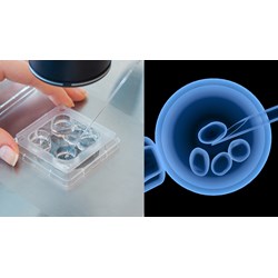 IVF là gì? Hiểu rõ hơn về phương pháp thụ tinh nhân tạo