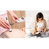 Siêu âm thai có được bảo hiểm y tế chi trả hay không?