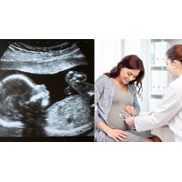 Phụ nữ có thai và nuôi con dưới 12 tháng tuổi có được tăng ca?