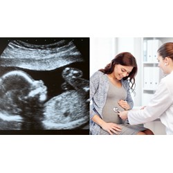 Phụ nữ có thai và nuôi con dưới 12 tháng tuổi có được tăng ca?