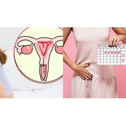 Có được tự quy định thời gian nghỉ của lao động nữ trong thời gian hành kinh không?