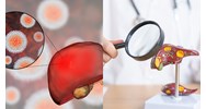 Bị nhiễm virus viêm gan B được làm những công việc nào theo quy định?