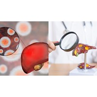 Bị nhiễm virus viêm gan B được làm những công việc nào theo quy định?