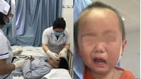 Quy trình thực hiện chăm sóc mắt ở người bệnh liệt VII ngoại biên