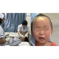 Quy trình thực hiện chăm sóc mắt ở người bệnh liệt VII ngoại biên