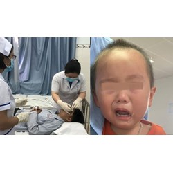 Quy trình thực hiện chăm sóc mắt ở người bệnh liệt VII ngoại biên