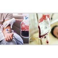 Truyền máu tự thân theo kế hoạch chỉ được thực hiện khi nào?