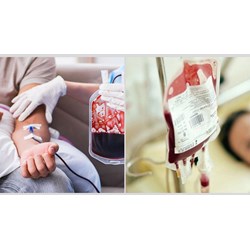 Truyền máu tự thân theo kế hoạch chỉ được thực hiện khi nào?