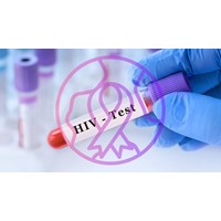 Thẩm quyền triển khai các biện pháp can thiệp giảm tác hại trong dự phòng lây nhiễm HIV