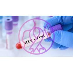 Thẩm quyền triển khai các biện pháp can thiệp giảm tác hại trong dự phòng lây nhiễm HIV