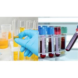 Quy định về lấy mẫu xét nghiệm chất ma túy trong cơ thể?