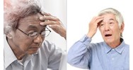 Bệnh Alzheimer là bệnh thuộc diện dài ngày được hưởng BHXH không?