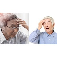 Bệnh Alzheimer là bệnh thuộc diện dài ngày được hưởng BHXH không?