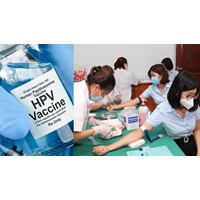 Lao động nữ có được xét nghiệm HPV khi khám sức khỏe định kỳ không?