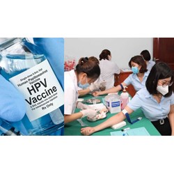 Lao động nữ có được xét nghiệm HPV khi khám sức khỏe định kỳ không?