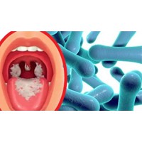 Bệnh bạch hầu có vắc xin hay thuốc kháng sinh điều trị hay chưa?
