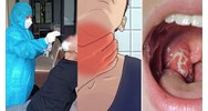 Có được làm việc tại nhà khi tiếp xúc với người mắc bệnh bạch hầu?