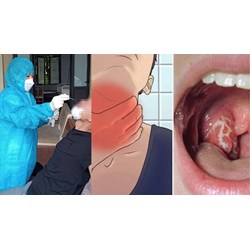Có được làm việc tại nhà khi tiếp xúc với người mắc bệnh bạch hầu?