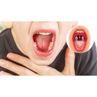 Nguyên tắc thực hiện việc phòng chống bệnh bạch hầu