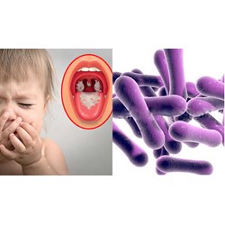 Có quy định về bệnh bạch hầu do vi khuẩn nào gây ra hay không?