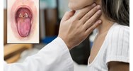 Có thể bị nhiễm bệnh bạch hầu khi tiếp xúc với đồ vật hay không?