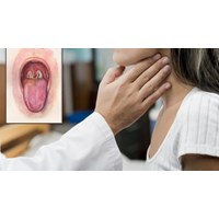 Có thể bị nhiễm bệnh bạch hầu khi tiếp xúc với đồ vật hay không?